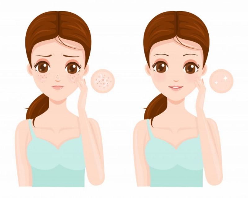 Mặt nạ cà chua tự nhiên giúp se khít lỗ chân lông, làm da mịn màng và giảm bã nhờn.